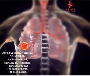 Understanding Lung Cancer ICD-10 Codes: A Key to Accurate Diagnosis ...