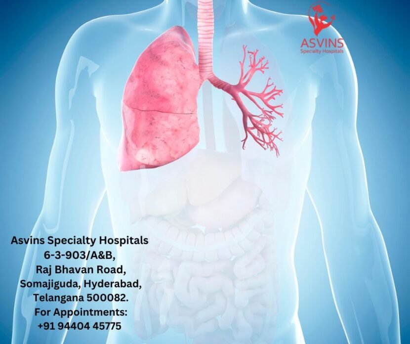 Navigating Lungs Cancer: Types, Symptoms, and Treatment - Asvins ...