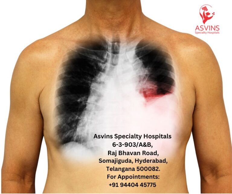 unveiling-lung-cancer-symptoms-that-manifest-on-the-skin-asvins