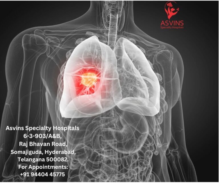 Understanding TNM Staging for Lung Cancer - Asvins Specialty Hospitals